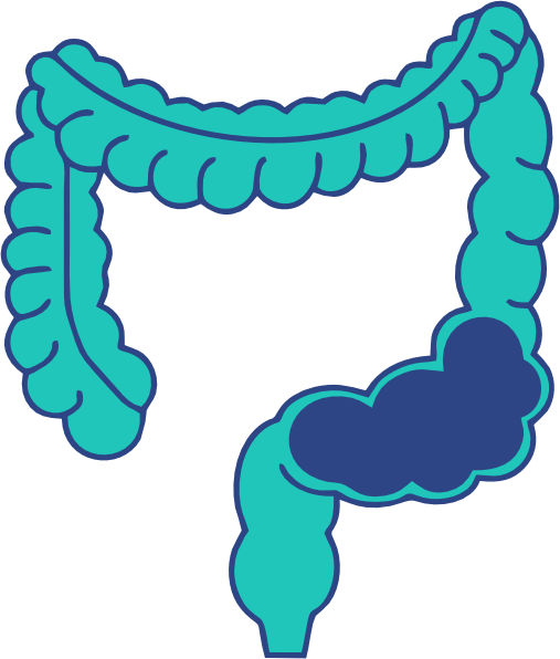 Intestinal Obstruction